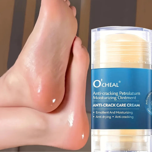 Anti Crack Foot Cream For Dry And Cracked Feet And Heels, Moisturizing Dry Feet And Heels, Preventing Your Feet From Cracking RoyalPrince Store